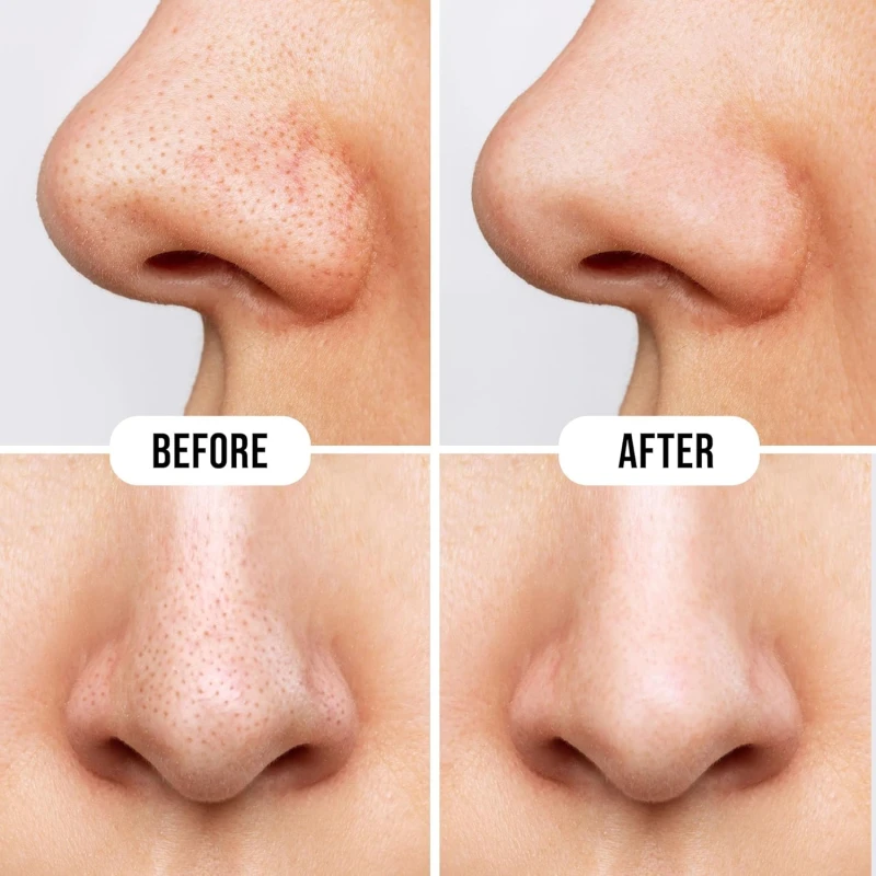 Hilary Rhoda Deep Cleanse Nose Strips | Instant Removal | Removes Blackheads | Removes Whiteheads | Deep Cleanses Skin &amp; Removes Dirt &amp; Oil | Formulated with Natural Extracts | 10 Strips (Honey - Shade 04) thumbnail 6